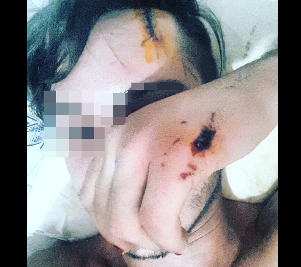 Vítima sofreu homofobia e foi estuprada após a Parada do Orgulho em Goiânia