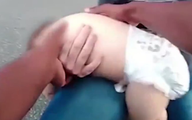 Criança de um ano passou cerca de 10 minutos sem conseguir respirar.