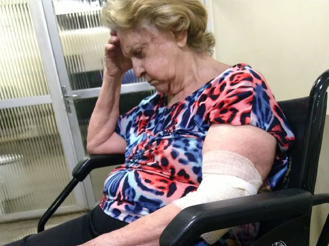Idosa quebra o braço após ser derrubada em hipermercado em Goiânia