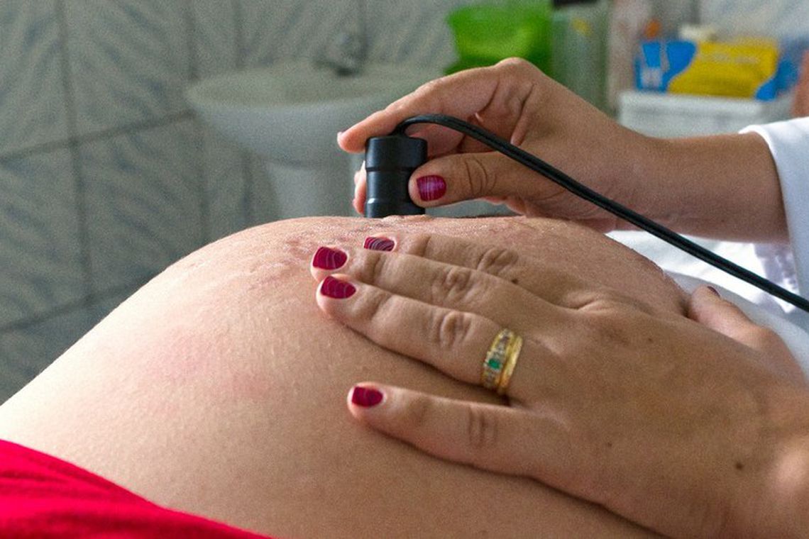 Caso único, Brasil passa de 200 mortes de grávidas e puérperas por Covid-19