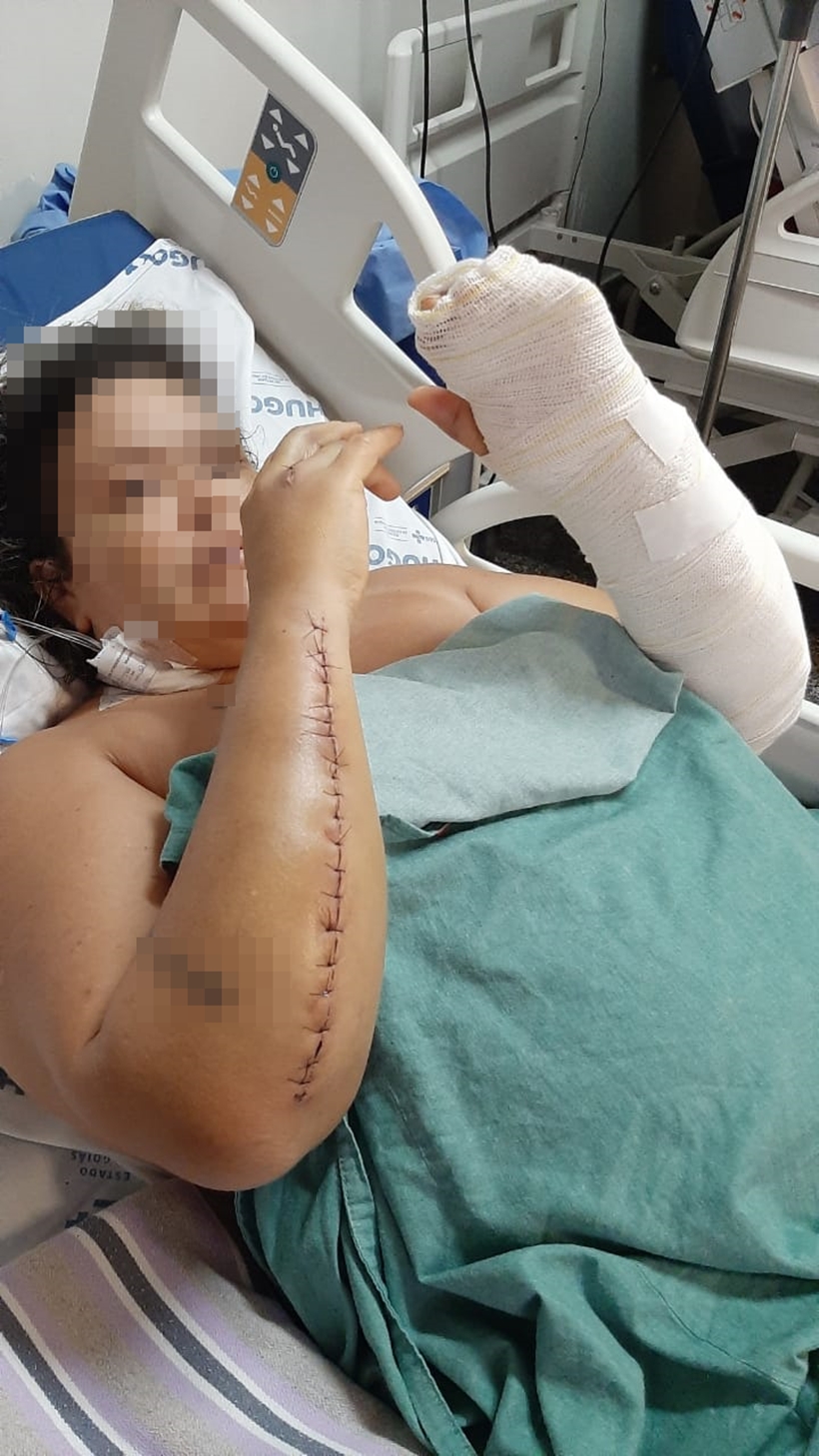Mulher espancada em Itaguari deve passar por mais duas cirurgias