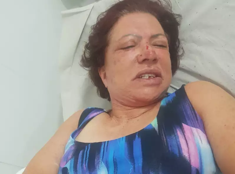 Suspeito de planejar assalto e agressão contra ex-primeira dama de Itaberaí era sobrinho da vítima e morreu em confronto com a PM