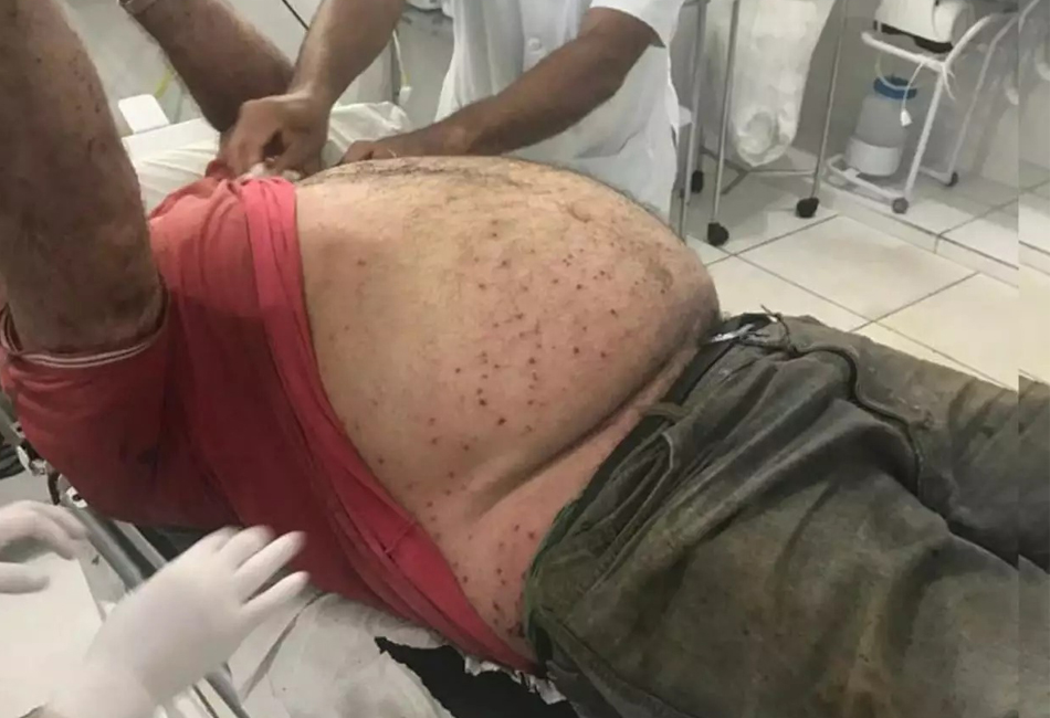 Um idoso, de 67 anos, identificado como Expedito, foi atacado por um enxame de abelhas em uma chácara da zona rural de Inhumas. (Foto: Divulgação/PM)