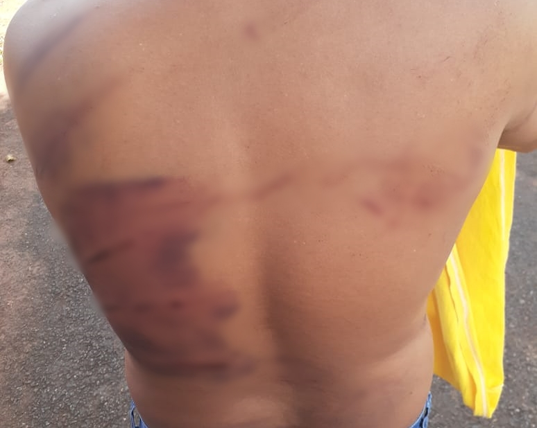 Motorista denuncia ter sido torturado por patrão após ser acusado de furto de R$ 8 mil (Foto: Divulgação)