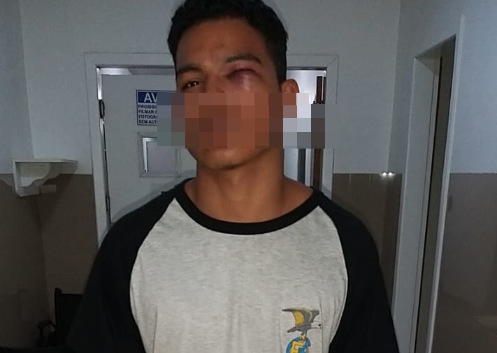 Rapaz agredido pela polícia em Posse