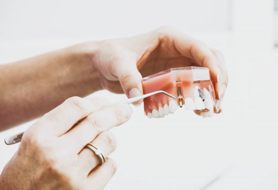 Clínica é condenada a indenizar paciente após perder próteses dentárias