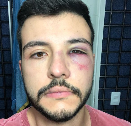 Matheus Ribeiro reage a tentativa de assalto e faz relato