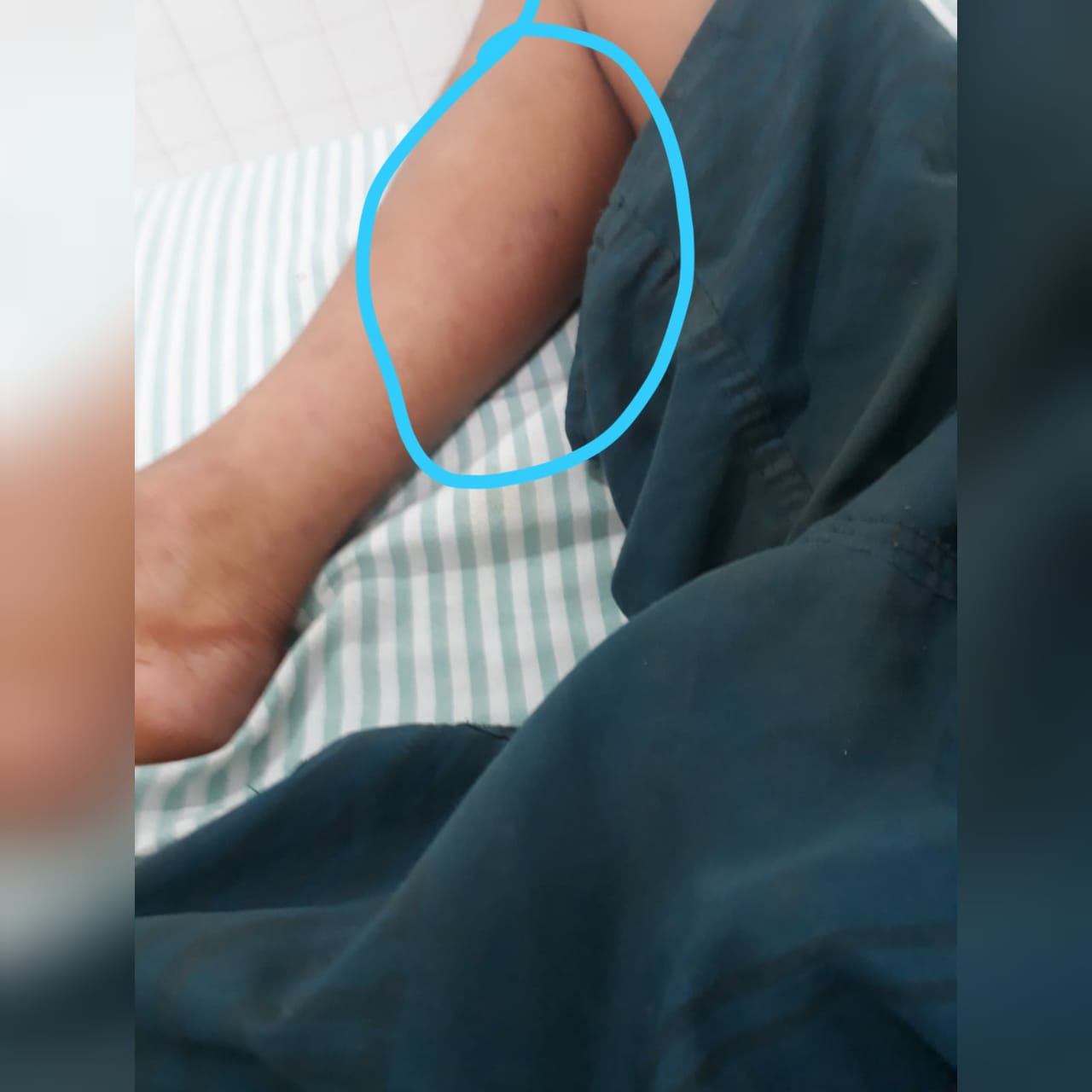 Uma criança, de 5 anos, precisou ser internada em uma UTI do Hospital de Doenças Tropicais (HDT), após ser picada por uma cobra em Ipameri. (Foto: arquivo)