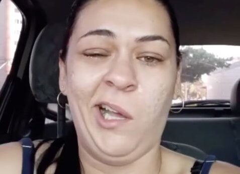 Úlida Guimarães: Conheça a jovem que viralizou com vídeo de rosto paralisado após anestesia