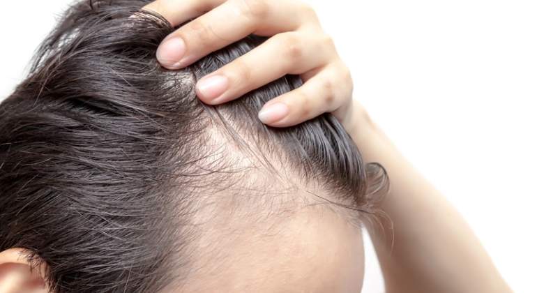 O sintoma pode ocorrer em pacientes de todas as idades e de ambos os sexos Covid-19 pode causar queda de cabelo meses após a contaminação