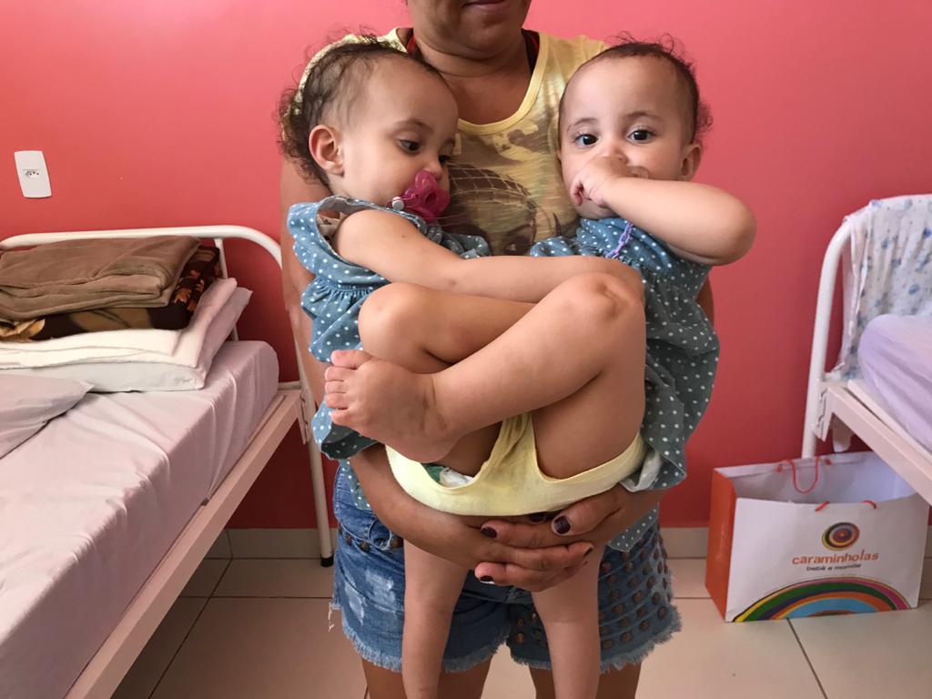Uma das gêmeas siamesas separadas por cirurgia no Hospital Materno Infantil, em Goiânia, receberá alta na manhã desta sexta-feira (12) (Foto: divulgação)