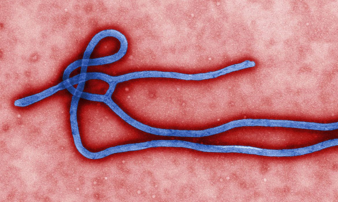 Homem que morreu no país tinha vírus altamente infeccioso, primeiro caso humano no oeste da África (Foto: Agência Brasil)