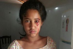 A família de Mikauany Barbosa Neves, de 12 anos, busca ajuda para conseguir um diagnóstico, depois que a menina começou a chorar lágrimas que se assemelham a sangue - Aos 12 anos, menina do Piauí busca diagnóstico após 'chorar' sangue