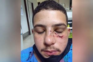 Jovem denuncia que foi agredido por cantor sertanejo, em Goiânia