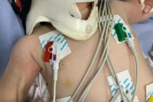 Bombeiros socorrem bebê de seis meses com 30 lesões em todo corpo em Anápolis
