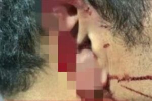 Após um desentendimento em bar, um homem teve parte da orelha arrancada com uma mordida durante uma luta corporal, em Mineiros