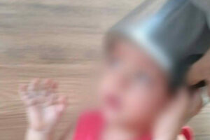 Bombeiros socorrem criança que prendeu a cabeça em panela de pressão, em Anápolis