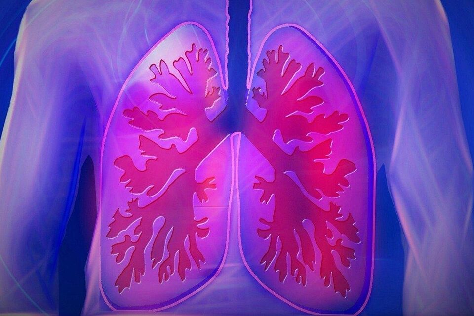 O primeiro estudo científico brasileiro a encontrar partículas de microplástico em pulmão humano acaba de ser concluído em São Paulo - Estudo inédito acha microplástico em pulmão humano