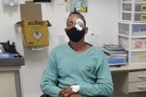 Homem atingido no olho pediu ajuda a policiais e foi ignorado, em Recife