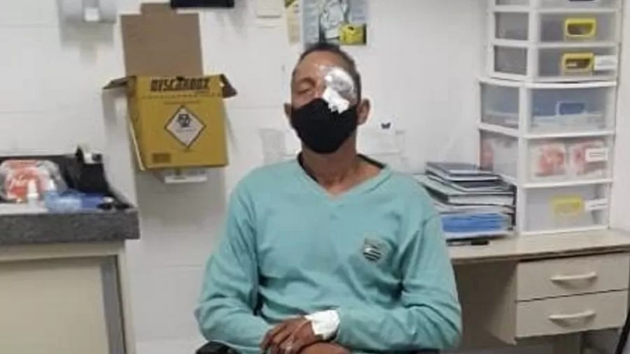 Homem atingido no olho pediu ajuda a policiais e foi ignorado, em Recife