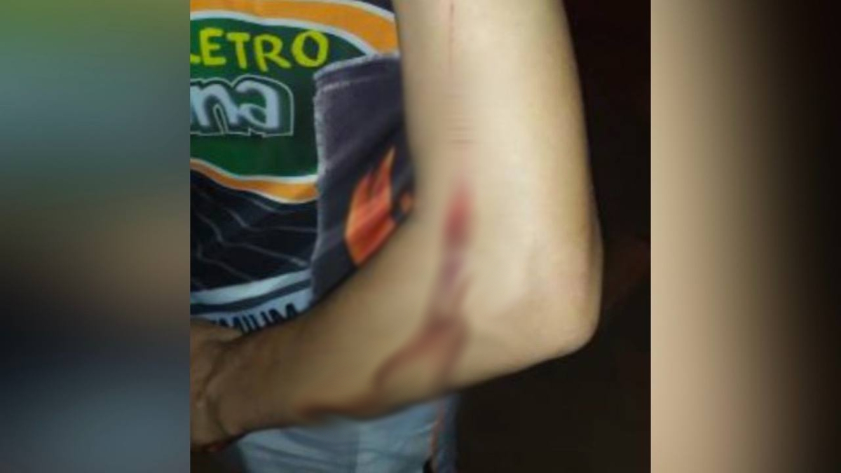 Suspeito cospe em idoso e esfaqueia homem em um bar, em Rio Verde. Apesar de estar bastante violento, ele foi preso