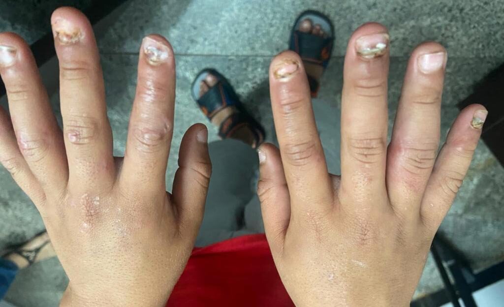 Pai confessou arrancar unhas de filho a mordidas e com alicate (Foto: divulgação/PC)