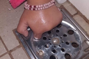 Enquanto brincava sentada no chão durante o banho, uma menina de 2 anos prendeu o dedo no ralo do banheiro, na cidade de Rio Verde