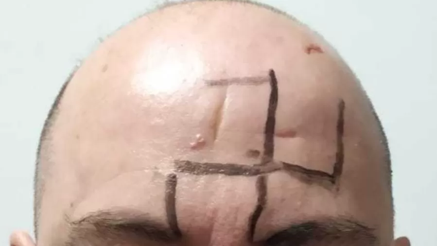 Homem gay é agredido e tem suástica desenhada na testa em ataque em MG