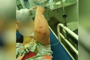 Mulher espancada durante quatro horas pelo marido aparece em maca de hospital