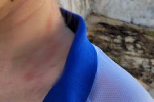 Foto mostra vítima com escoriações no pescoço. Ela usa uma camiseta do brasil, nas cores brancas e detalhes azuis. Pai é suspeito de agredir filha por ela passar mais tempo com a mãe, em Pirenópolis