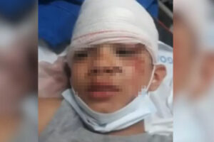 Polícia busca motorista que atropelou criança e fugiu sem prestar socorro em Goiânia
