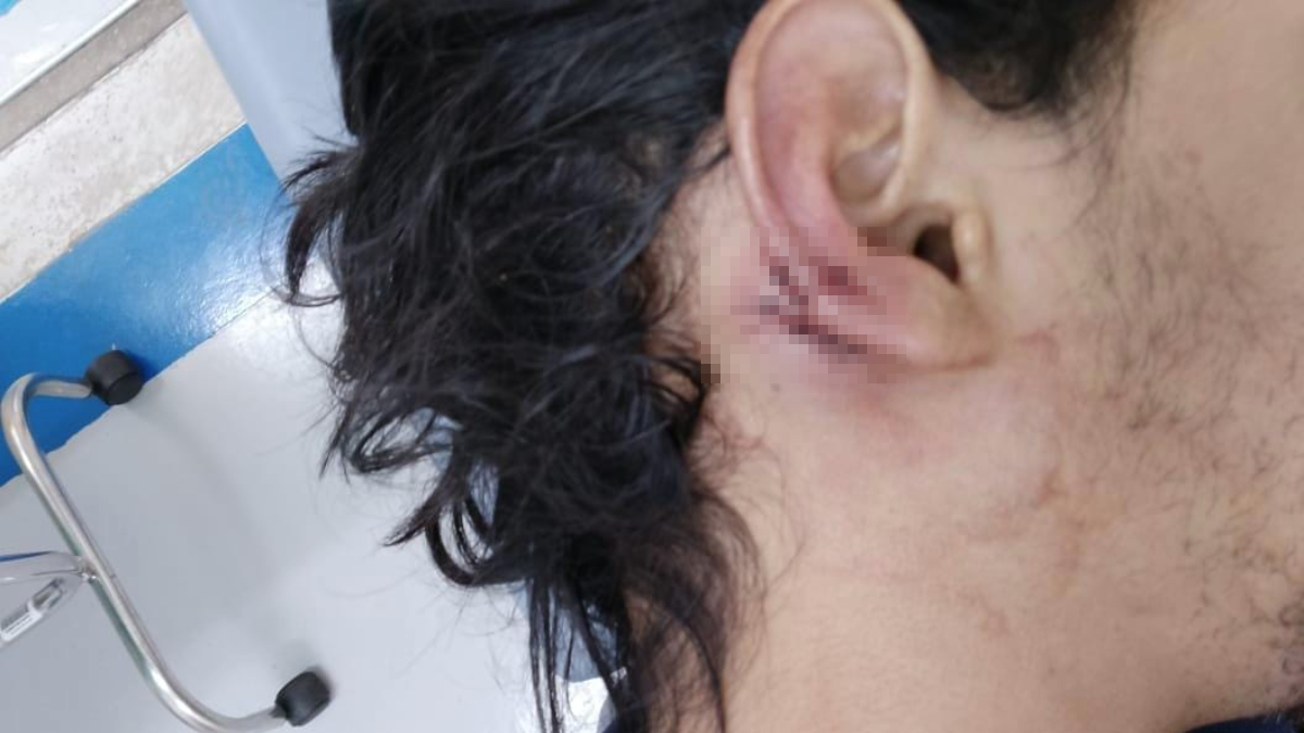 Jovem mostra a orelha suturada em 3 locais diferentes, após briga de trânsito em Goiânia