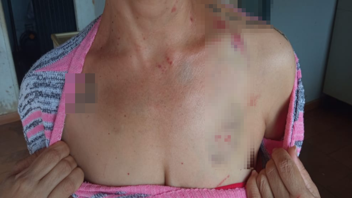 Após apoio de médicos, mulher denuncia ex-marido por agressão com chave de fenda em Jandaia (Foto: Reprodução - Arquivo Pessoal)