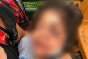 Criança de 4 anos atacada por cachorro se recupera em casa, em Goiânia