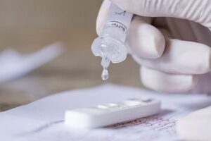 Fiocruz: positividade de testes RT-PCR subiu de 3% para 37% em janeiro