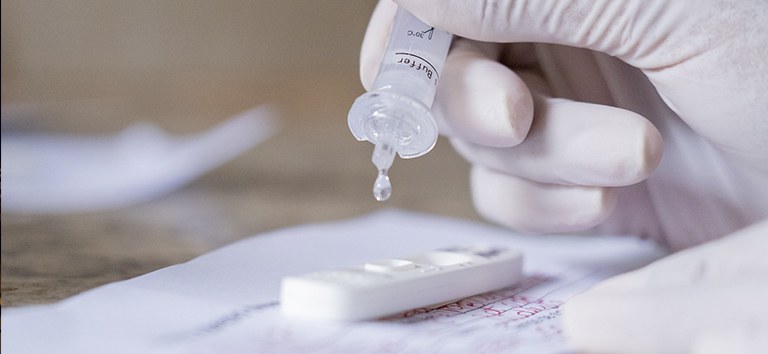 Fiocruz: positividade de testes RT-PCR subiu de 3% para 37% em janeiro