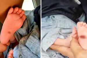 Pais denunciam hospital em Goiânia por queimar pés de bebê em incubadora