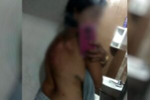 Suspeito de jogar óleo quente nas costas da namorada é preso em Santa Helena de Goiás (Foto: Polícia Militar)