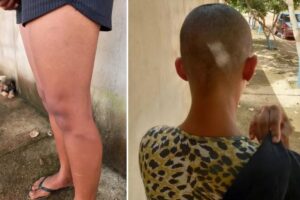 Suspeito de agredir e raspar o cabelo da namorada por suspeitar de traição é preso em Nova Iguaçu