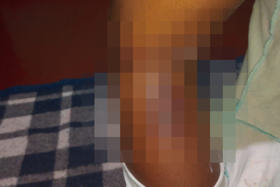 Goiás - Mãe queima filha com colher após agredi-la por 