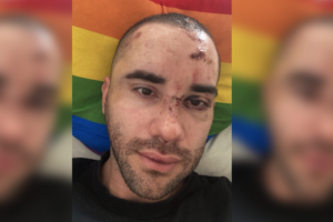Vítima de homofobia, homem em crise de pânico é espancado por grupo ao sair de boate em SP (Foto: Reprodução)