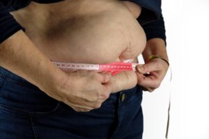 Mais da metade do mundo estará com sobrepeso ou obesidade até 2035 No Brasil, 4 em cada 10 adultos brasileiros serão obesos